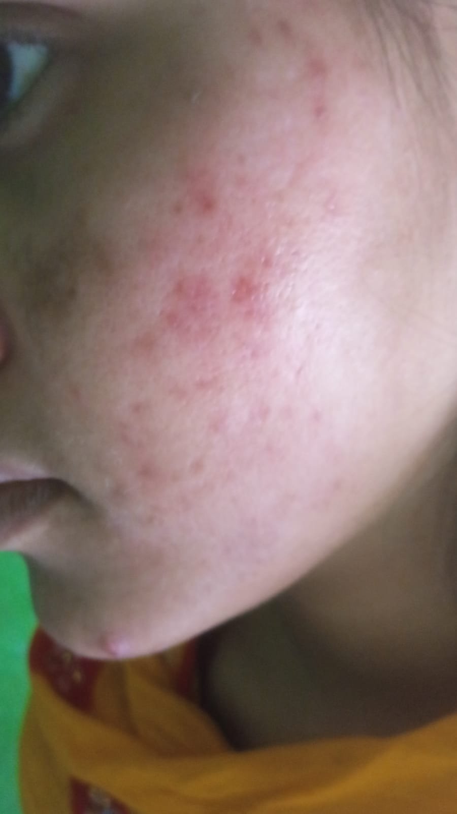 After